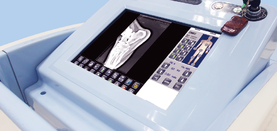 床旁移動(dòng)DR