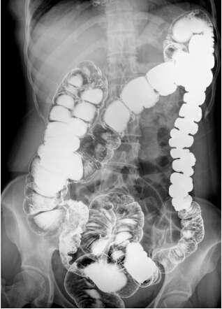 動(dòng)態(tài)DR和胃腸機(jī)有什么區(qū)別嗎？