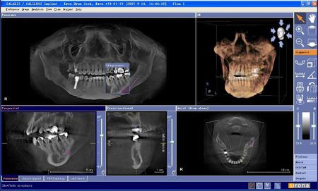 看牙齒為什么要拍片？