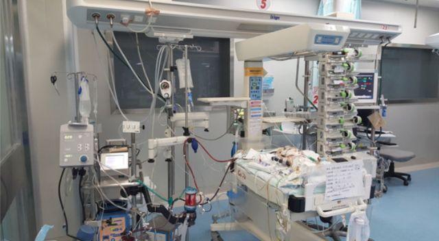 醫(yī)療器械ECMO